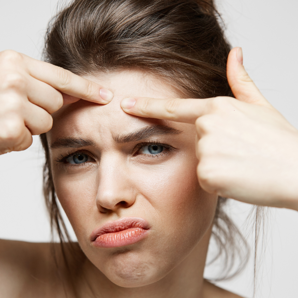 Bőrápolás bőrtípus szerint 2. Zsíros, problémás bőr